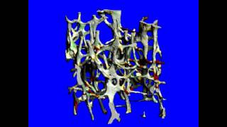 Finite Element Simulation on microCT of Cortical Bone
