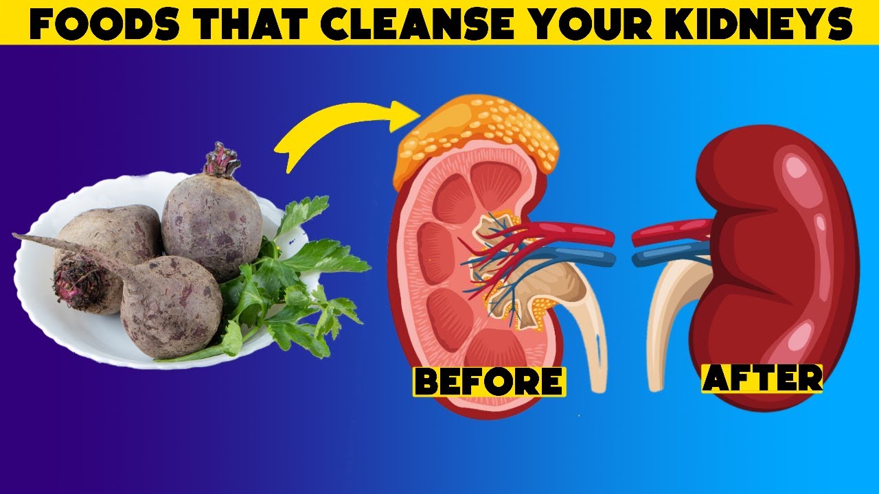Top 7 Foods That Will Cleanse Your Kidneys Fast - YouTube
