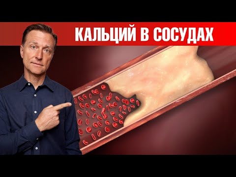 видео: Главная причина кальцификации сосудов‼️ Кальций в сосудах