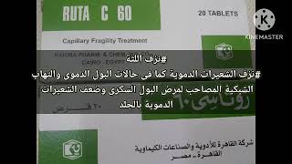 روتاسى لعلاج ضعف الشعيرات الدموية ونزيف اللثة&روتين&فيتامين سى&الكدمات الزرقاء بالجسم&نزيف الأنف