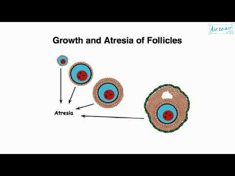 Video: Wat is atretiese ovariale follikels?