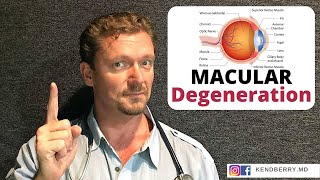 MACULAR Degeneration (Prevent It / Improve It)  2024