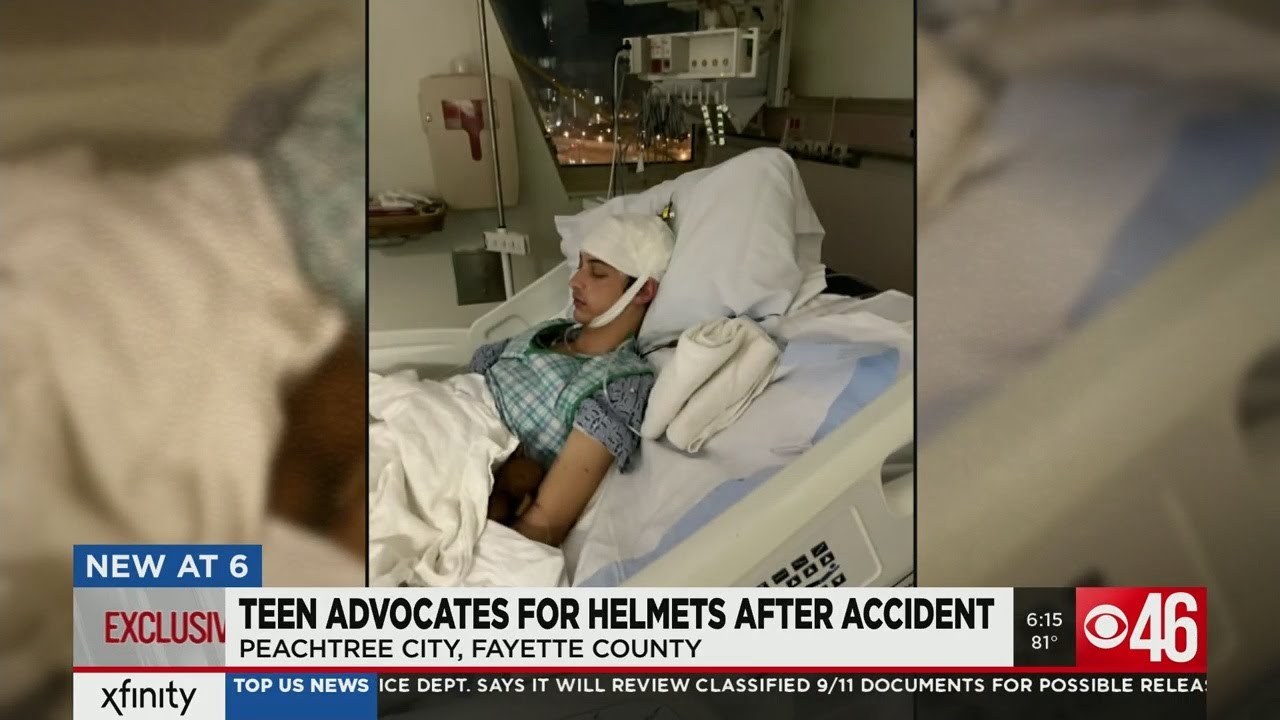 Teen advocates for helmets after skating accident