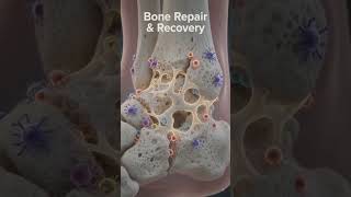 :Ankle Fracture Treatment Recovery Explained Symptoms, X-Ray, Bone Healing #anklepain #brokenankle