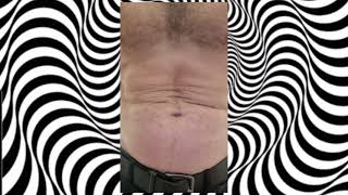 Hypno-Belly..... Itll Cure Pretty Much Everything, If You Will It So