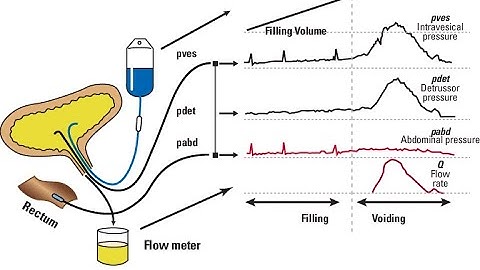 URODYNAMIC STUDY IN CHILDREN-BASICS TO ADVANCED