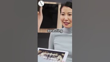 AI Revolutionizing X-Ray Diagnostics!