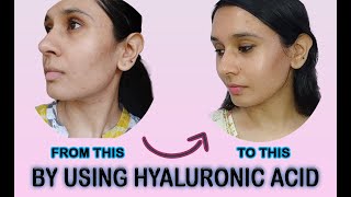 Give your skin a boost of hyaluronic acid Ft Sanfe Hyaluronic Acid | Skin Transformation