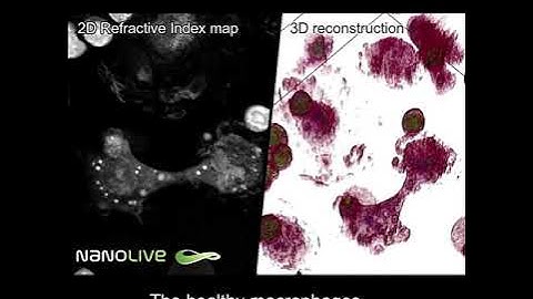 The perfect murder - Macrophage cell killed by T-cells