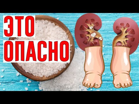 8 ПРИЗНАКОВ ТОГО, ЧТО ВЫ ЕДИТЕ СЛИШКОМ МНОГО СОЛИ!