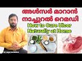 How to Cure Ulcer Naturally at Home, അൾസർ മാറാൻ ഫലപ്രദമായ നാച്ചുറൽ റെമഡി, Stomach Ulcer, Mouth Ulcer