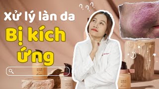 XỬ LÝ LÀN DA BỊ KÍCH ỨNG | BS.BẢO NGÂN