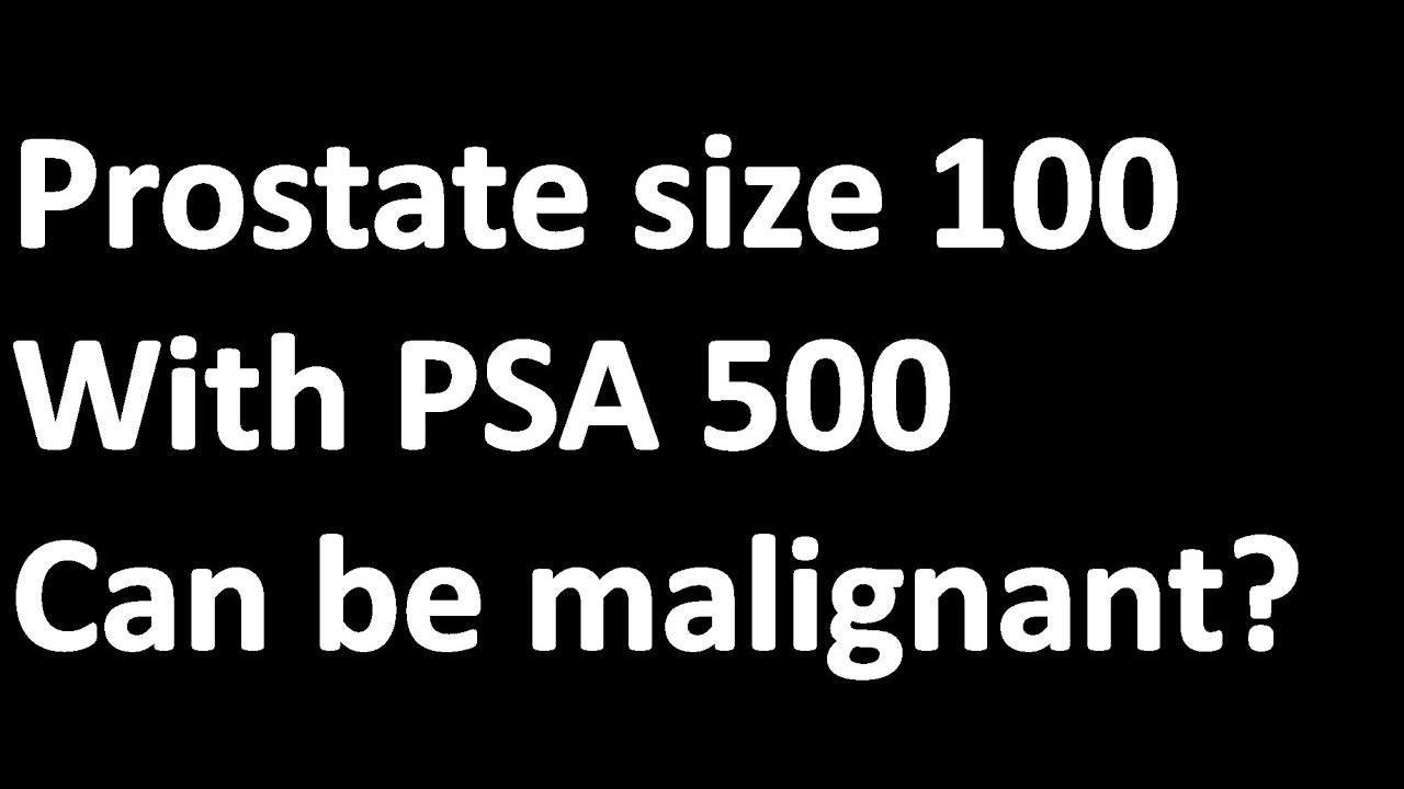 prostate-size-100-with-psa-500-can-be-malignant-youtube
