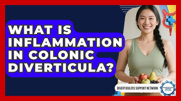 What Is Inflammation In Colonic Diverticula? - Diverticulitis Support Network