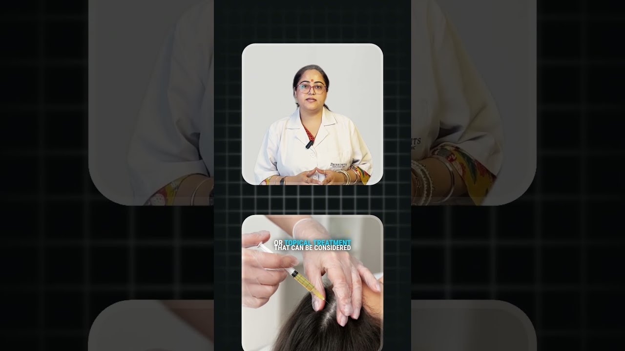 Hairline Receding in Your 20s? | Causes of Hair Loss