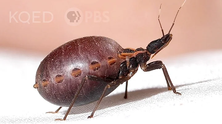 How a Kissing Bug Becomes a Balloon Full of Your B...