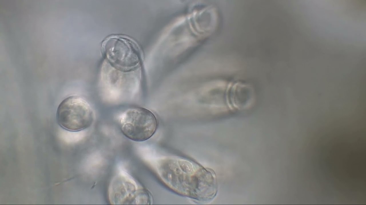 Vorticellidae, ciliates