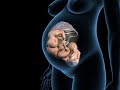 Types of triplets pregnancy  dichorionic diamniotic triplets  3d anatomical visualization