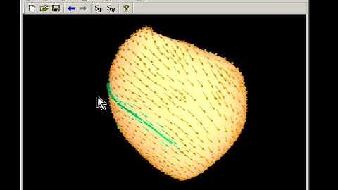 A Sketch-Based Interface for Modeling Myocardial Fiber Orientation (Smart Graphics 2007)