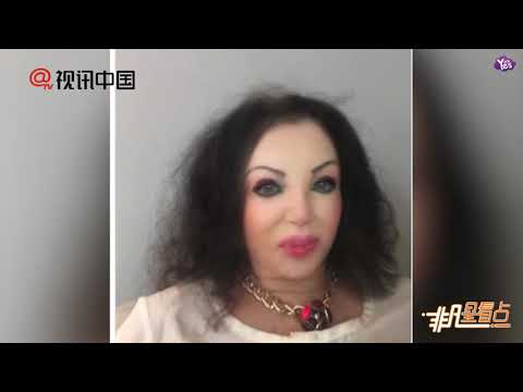 【近期】史泰龍媽媽為小30歲老公整容！近照流出似假人