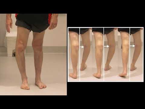 Knee History and Examination Video