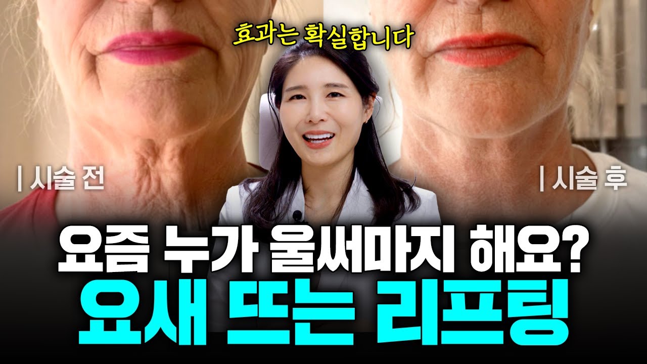 울써마지 말고 이거 해달라고 하세요! 요즘은 무조건 'ㅇㅇㅇ' 받습니다!