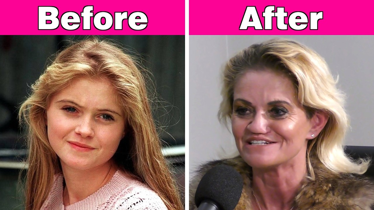 60+ Shocking! Hollywood Celebrities Before Surgery | Before and After