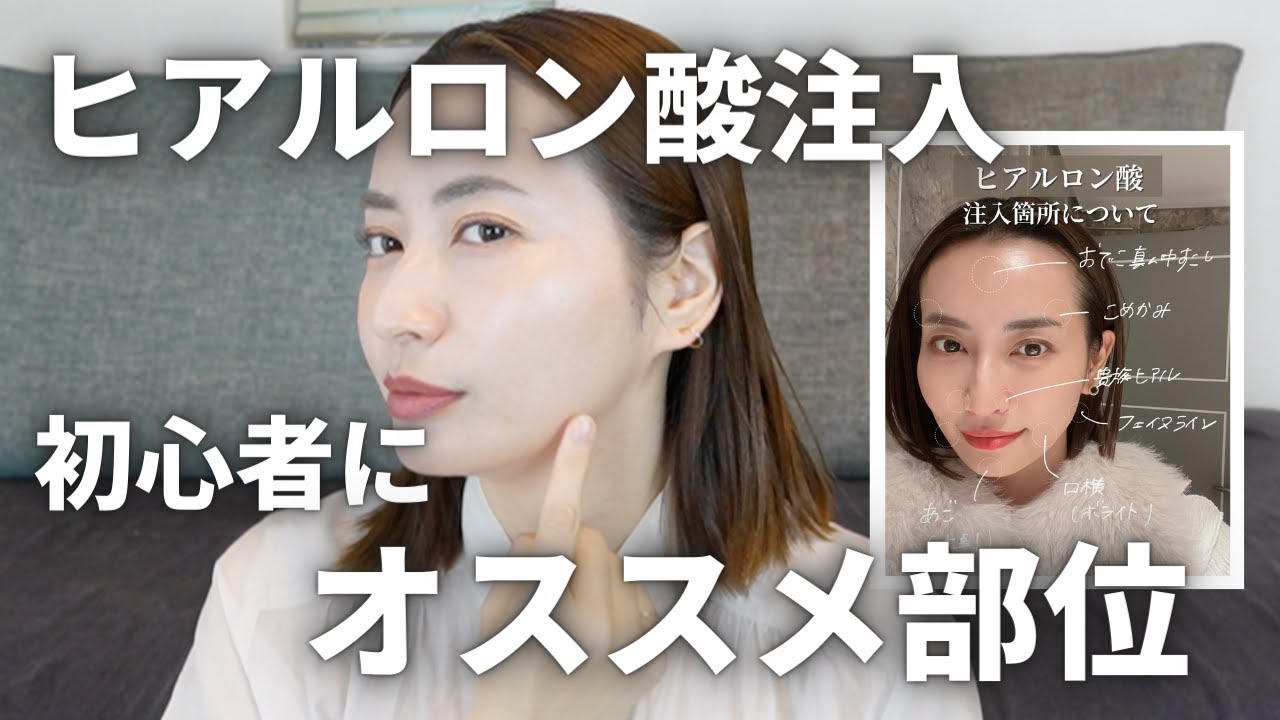 ヒアルロン酸を考えてる人は、まずはこれを見て【ヒアルロン酸の教科書