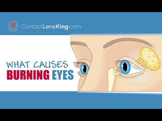 Why Do My Eyes Burn When I Cry: Causes and Treatments