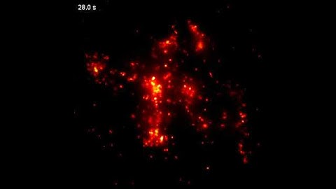 Tracking fluorescence nanoparticls in a living cancer cell