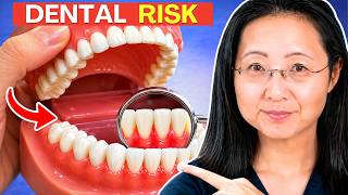 Doctor Reacts to Dental Risks