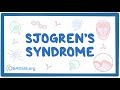 Sjogren's syndrome