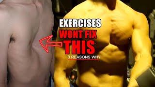 Exercises Alone Wont Fix Pectus Excavatum  (3 Reasons Why)