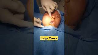 Large Tumor examination before surgery screenshot 4