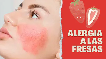 ¿Quién es alérgico a la fresa?