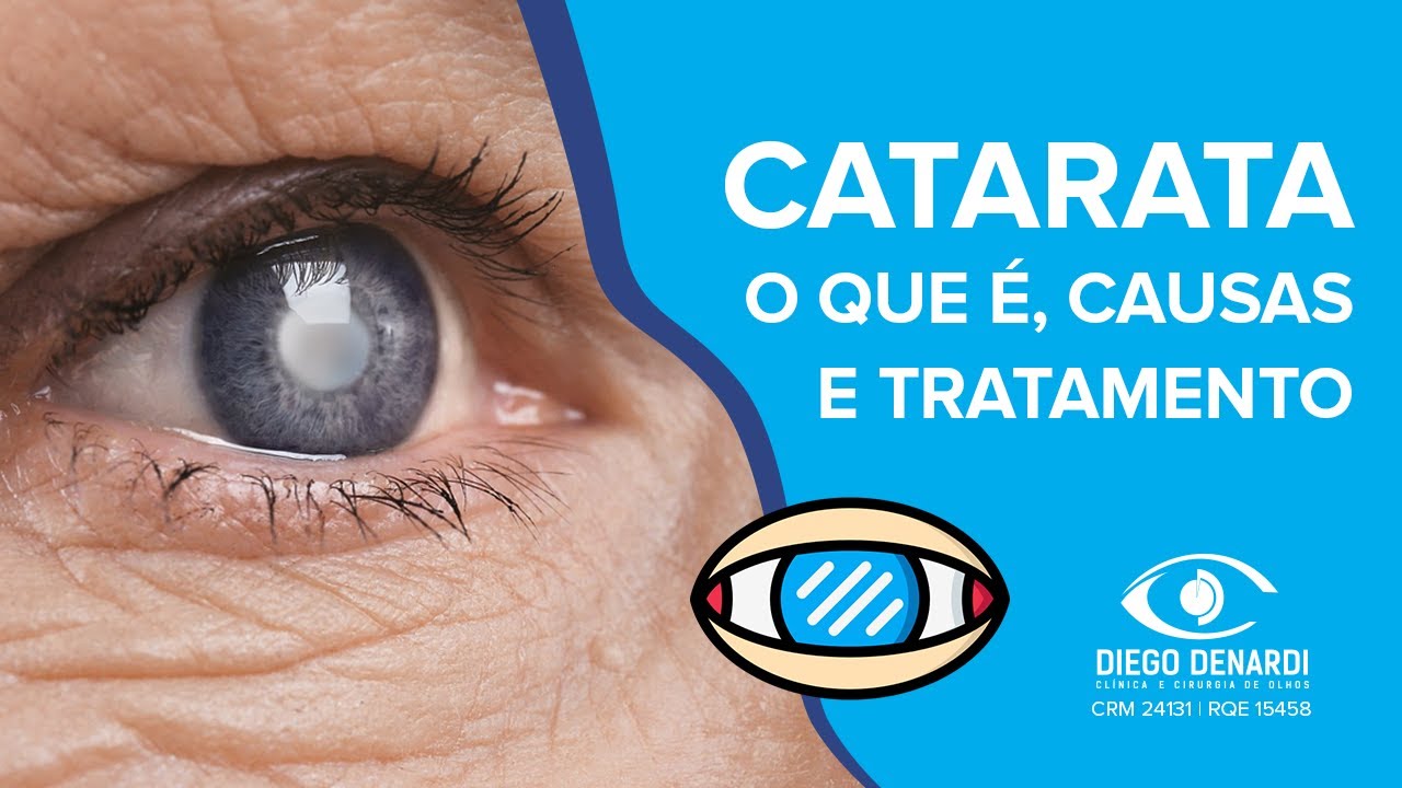 Como a blefarite afeta os olhos – Donato Hospital de Olhos