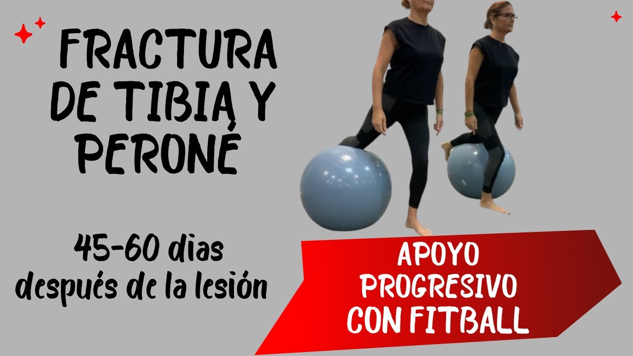 Fractura de tibia y peroné, ejercicios de apoyo progresivo 