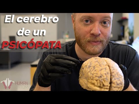 Dentro del CEREBRO de un PSICÓPATA...