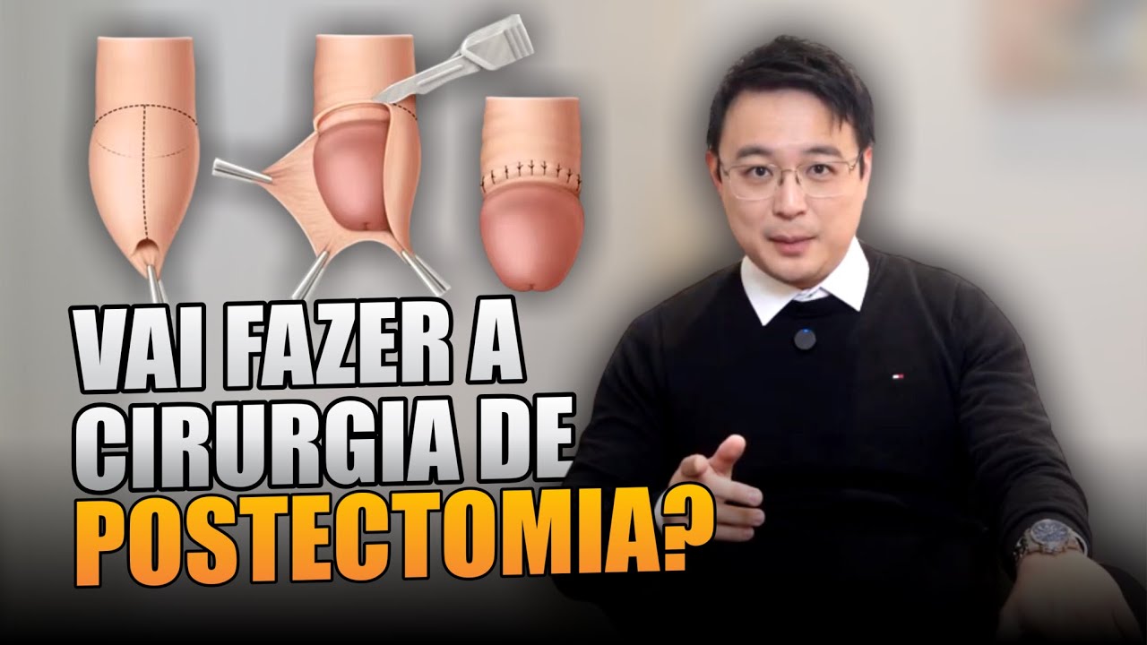 Vai fazer postectomia? Saiba como ter uma recuperação tranquila! | Dr. Wilson Sato