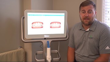 Invisalign and the iTero scanner creating beautiful smiles.