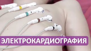 ЭКГ - электрокардиография в детской клинике Фэнтези.(Где сделать ребенку электрокардиографию в Москве? По этой ссылке http://fantasyclinic.ru/services/lechenie/kardiologiya/ekg-elektrokardiograf..., 2016-05-27T14:05:26.000Z)