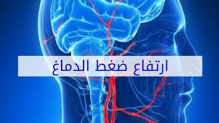 تجربتي مع ضغط الدماغ المرتفع ونتيجه الرنين المغناطيسي هما سبب تأخيري عليكم