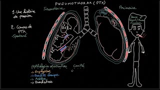 Pneumothorax - Docteur Synapse