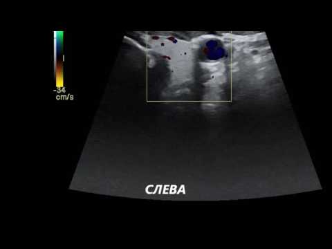 БЦА - YouTube