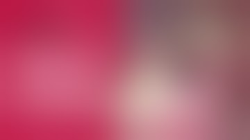 Immediate implant placement in lower molar - [Dr. Kim Yongjin]