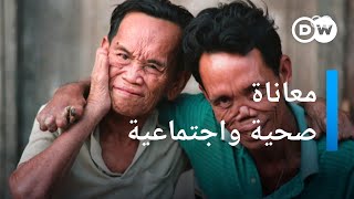 الجذام..لماذا يمثل القضاء عليه تحديا كبيرا؟ |  الأخبار