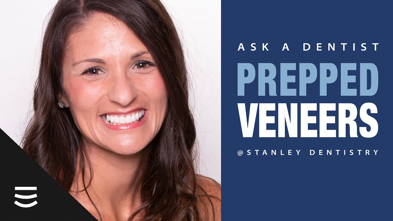 Ask a Dentist: Prepped Veneers