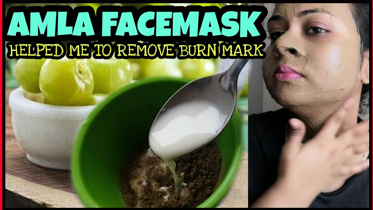 AMLA FACEPACK TO REMOVE BURN SCAR AND DARK SPOT😍 HELPED ME TO REMOVED MY BURN MARK FROM FACE😍DEMO