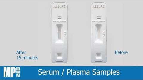 ASSURE SARS-CoV-2 Antibody rapid test kit - user instructional video [MP Biomedicals Asia Pacific]