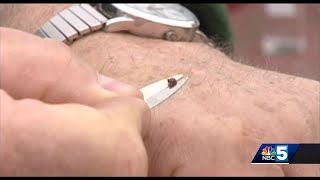 Tips on avoiding ticks and lyme disease